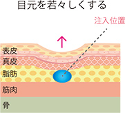 注入位置の説明図。目元を若々しくする