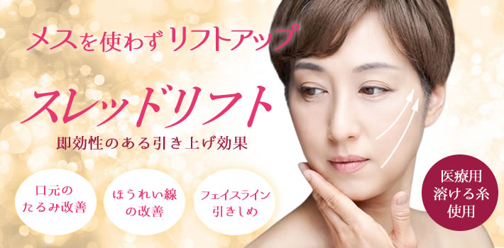 メスを使わずリフトアップ スレッドリフト 即効性のある引き上げ効果 口元のたるみ改善・ほうれい線の改善・輪郭引きしめ 医療用溶ける糸使用