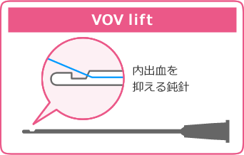 挿入時に用いる針の比較(VOV lift)