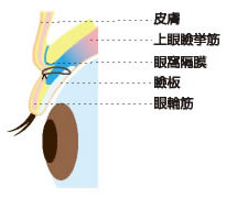 二重埋没法②