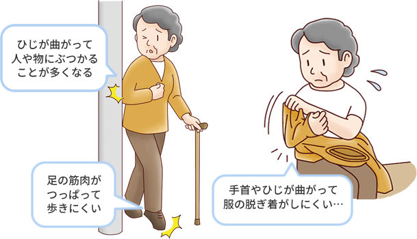 痙縮のため日常生活に困る症状