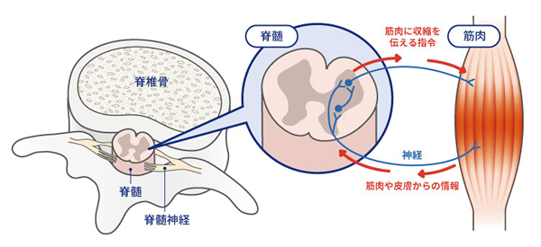 痙縮の病因